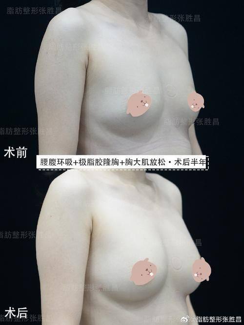 青岛亿嘉琏医疗美容诊所是正规医院吗？