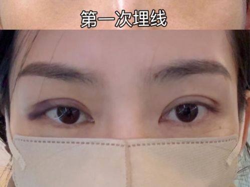 青岛亿嘉琏医疗美容诊所特色项目及技术优势