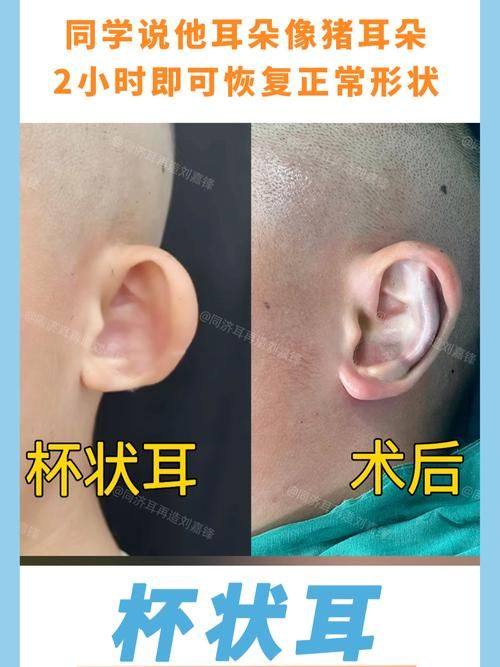 新乡穆大夫整形美容医院详细的预约挂号方式及流程