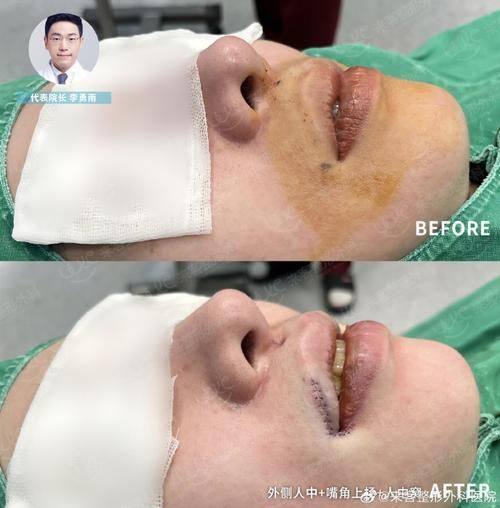 山东省泰山疗养院整形外科详细的预约挂号方式及流程