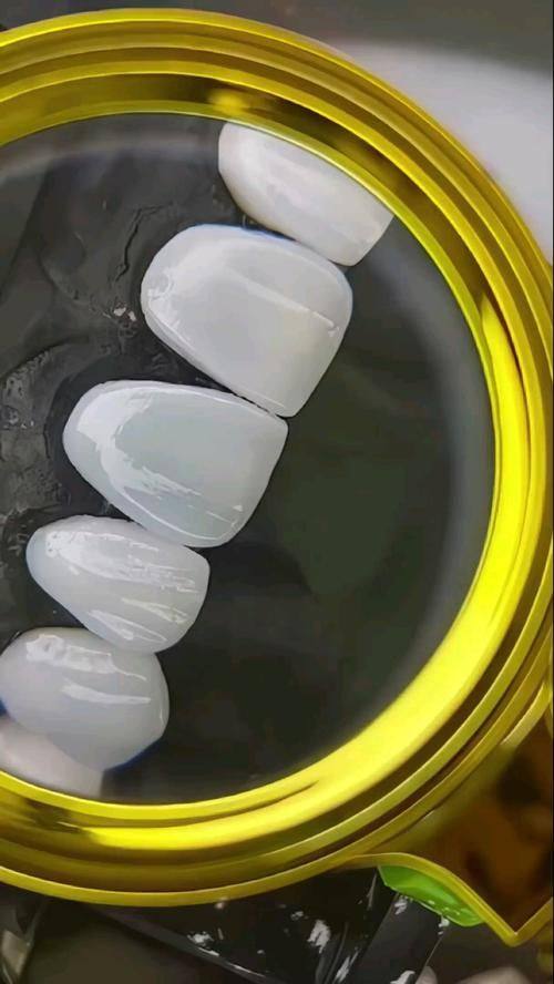 西安种永锋口腔收费价格表/收费标准