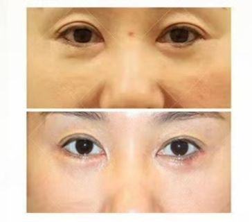 口碑评价及真人实例