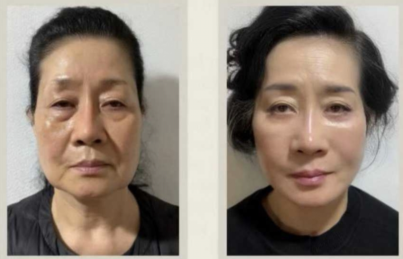 山东省泰山疗养院整形外科真人口碑评价怎么样？