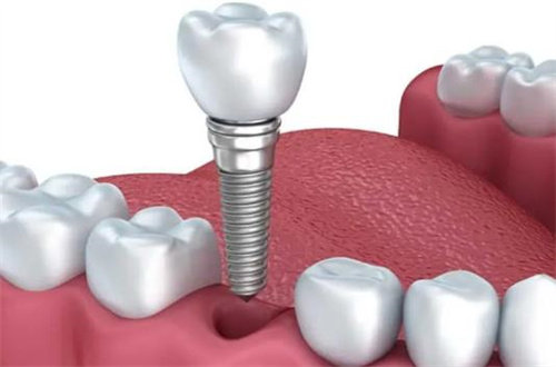 深圳欧雅口腔门诊部地址电话营业时间