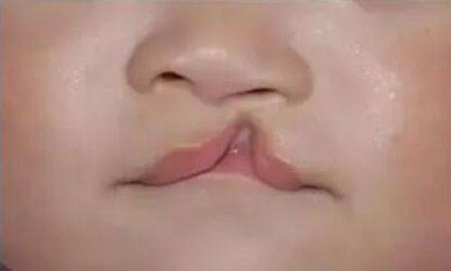 广州广大整形美容医院是正规医院吗？