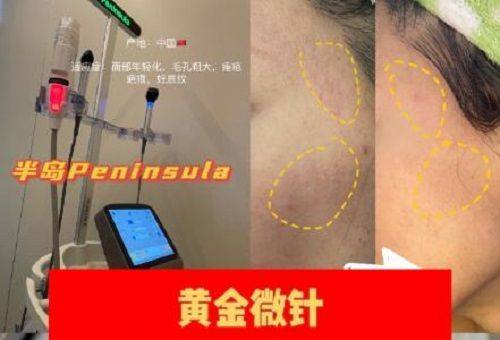 李州民医生技术优势