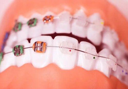 安阳龙安添悦口腔诊所（帕提欧院区）详细的预约挂号方式及流程