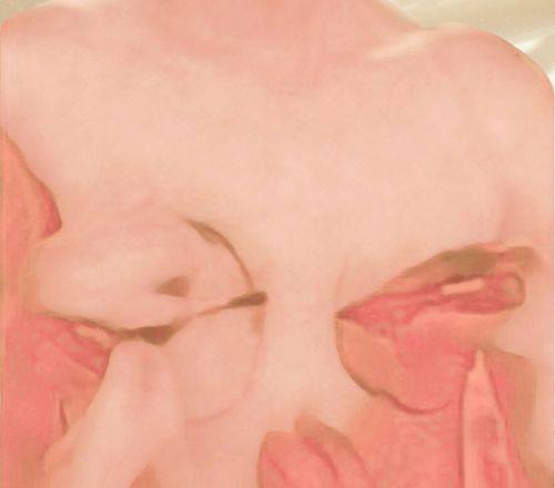 西安顺美整形医院收费价格表/收费标准