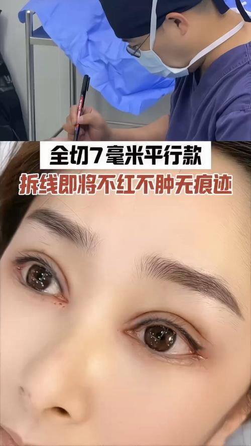 西安顺美整形医院是正规医院吗？