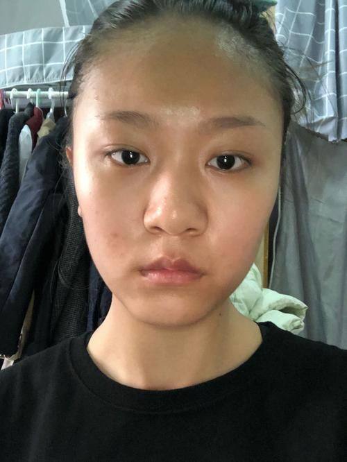 西安顺美整形医院真人口碑评价怎么样？