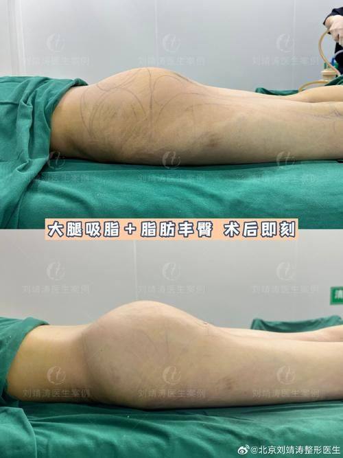 简阳卡秀整形医院详细的预约挂号方式及流程