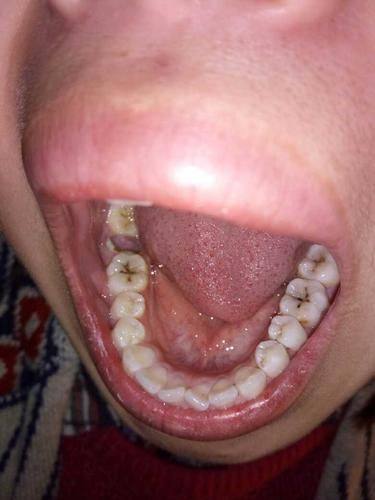 东莞长安雅健口腔门诊部地址电话营业时间