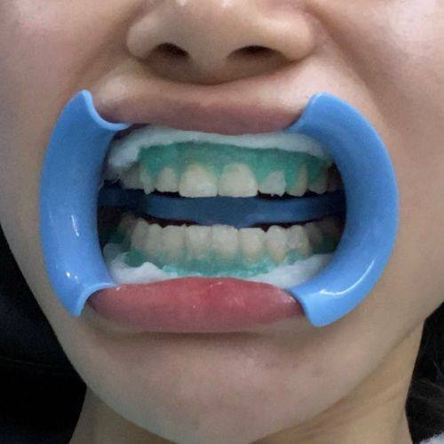 东莞长安雅健口腔门诊部特色项目及技术优势