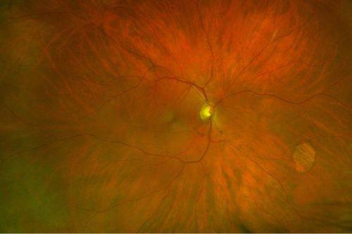 丹阳市第三人民医院眼科收费价格表/收费标准