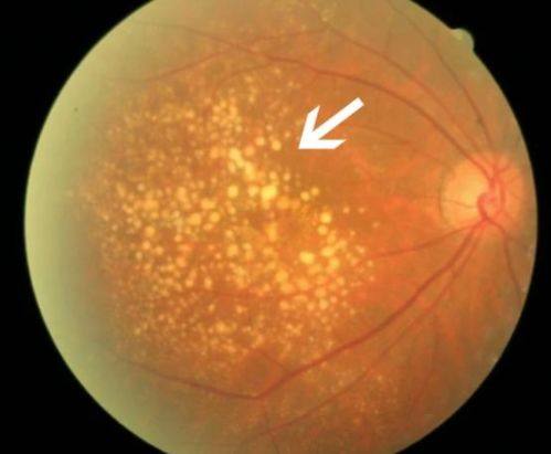 丹阳市第三人民医院眼科详细的预约挂号方式及流程