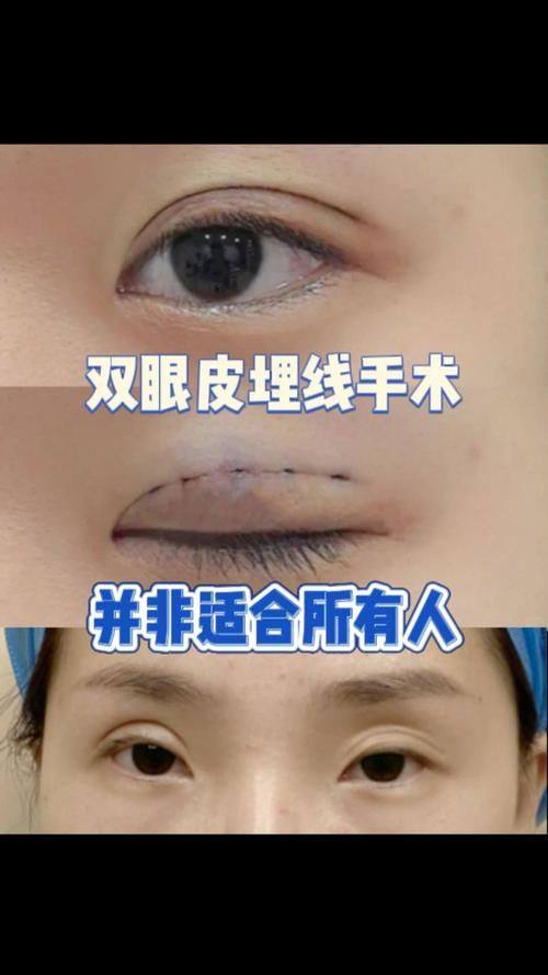 廊坊艾美整形地址电话营业时间