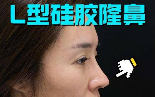 肇庆市雪罗兰美容院收费价格表/收费标准