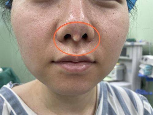 廊坊艾美整形真人口碑评价怎么样？