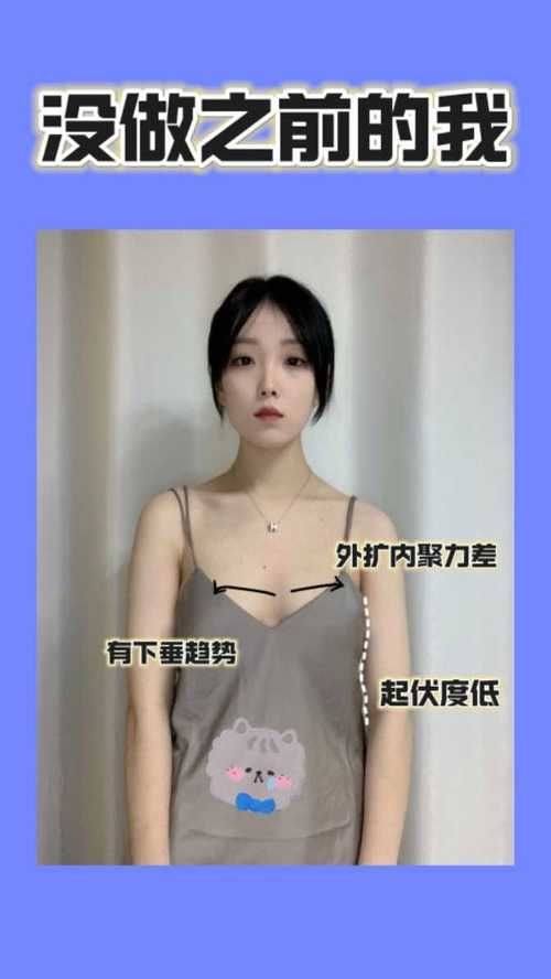 廊坊艾美整形特色项目及技术优势