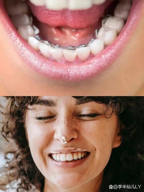 苏州泰康拜博星湖口腔诊所收费价格表/收费标准