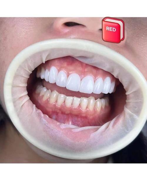 苏州泰康拜博星湖口腔诊所真人口碑评价怎么样？