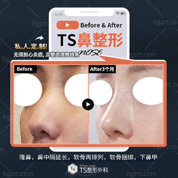 韩国TS整形医院简介概述