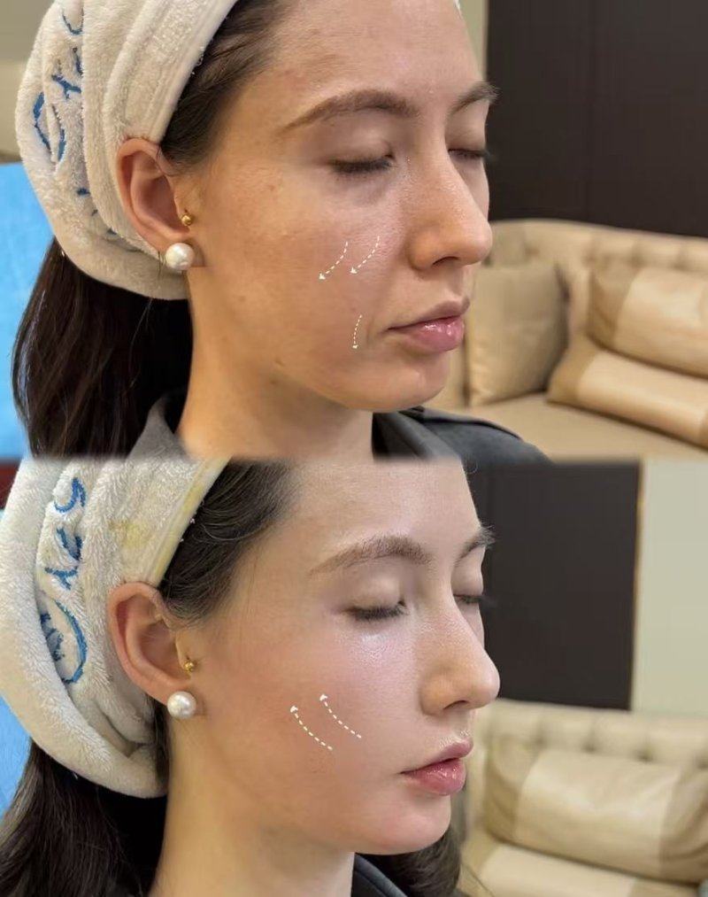 王慜医生技术优势