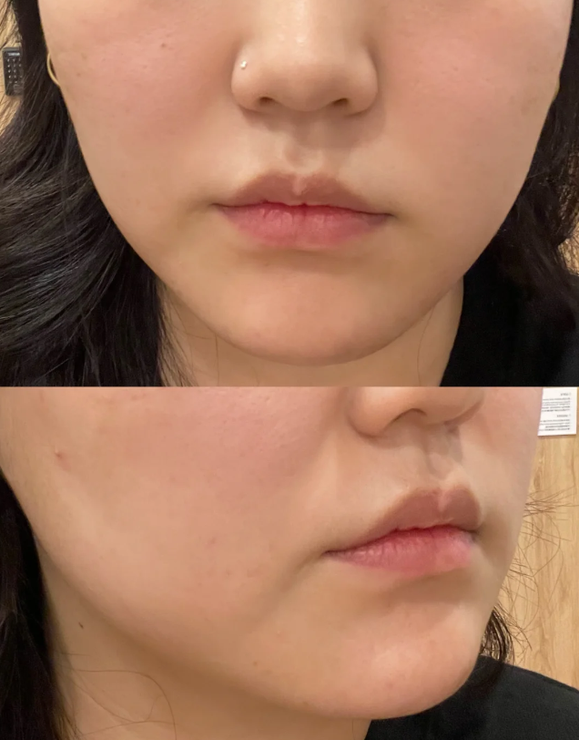 王慜医生擅长项目