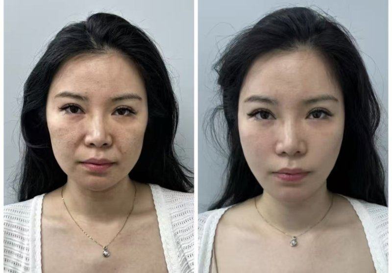 李州民医生擅长项目