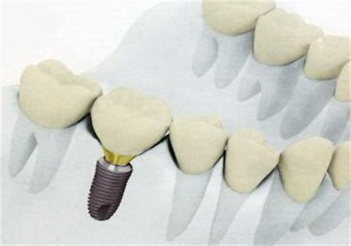 罗力民医生擅长项目