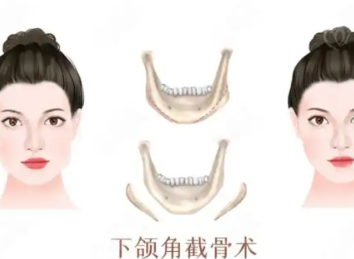 陈秀琴医生技术优势