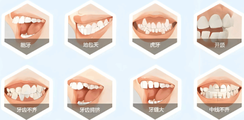 陈小丽医生技术优势