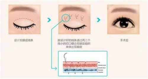 广西菲洛嘉医疗美容门诊部地址电话营业时间