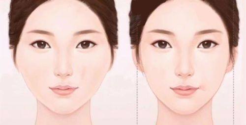 秦瑜医生口碑评价及真人实例