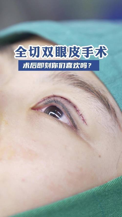 苏州常熟圣莎拉医疗美容门诊部收费价格表/收费标准