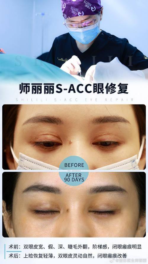 苏州常熟圣莎拉医疗美容门诊部特色项目及技术优势