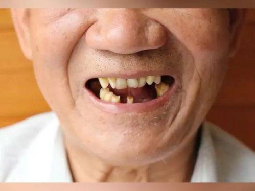 兰州七里河雅新皓康口腔门诊部是正规医院吗？