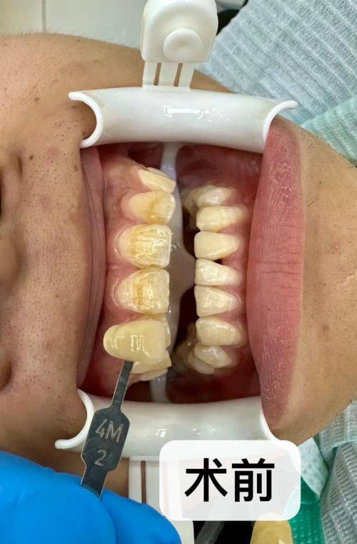 衢州柯城傅氏口腔诊所详细的预约挂号方式及流程