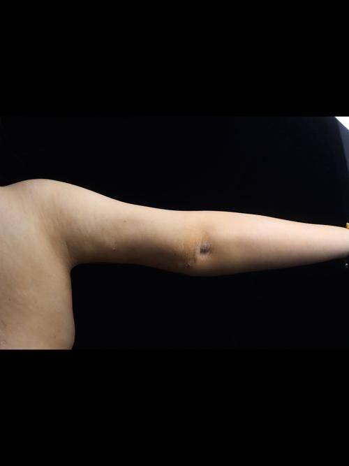 南宁美冠医疗美容诊所收费价格表/收费标准