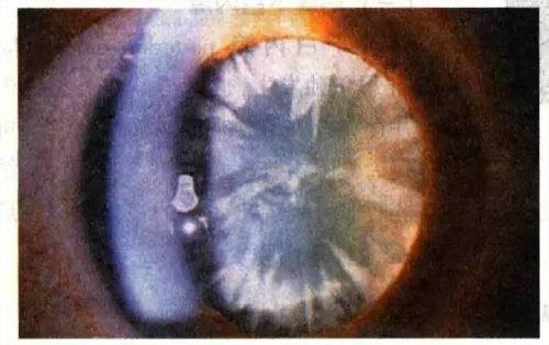 昆山第一人民医院眼科收费价格表/收费标准