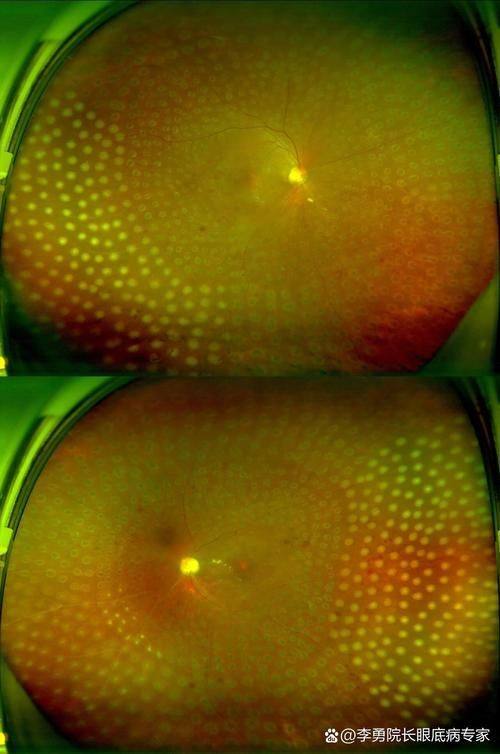 景洪市第一人民医院眼科医生团队实力强大及骨干医生简介