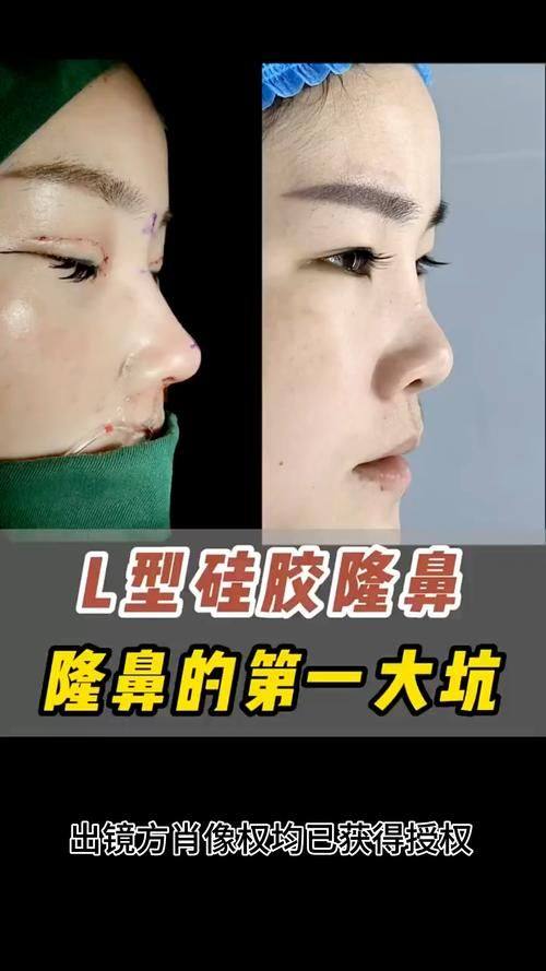 南宁美冠医疗美容诊所是正规医院吗？