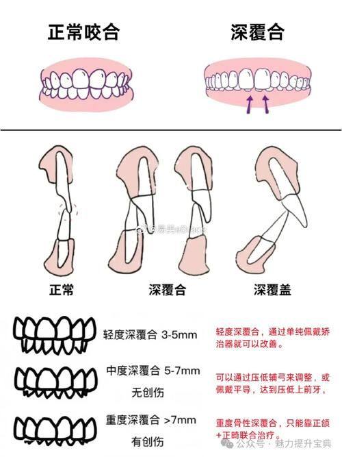 佛山欧贝丽口腔真人口碑评价怎么样？