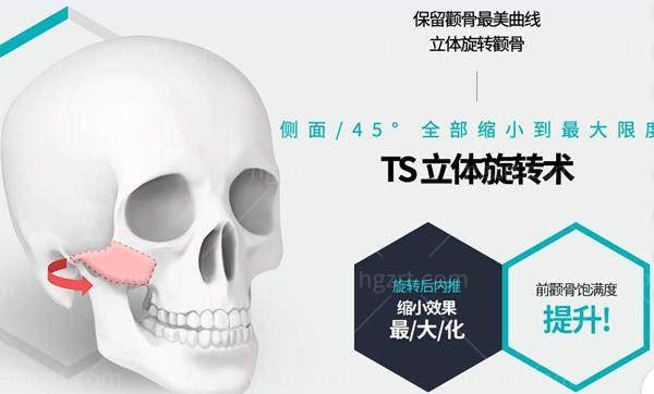 李昇燦医生技术优势