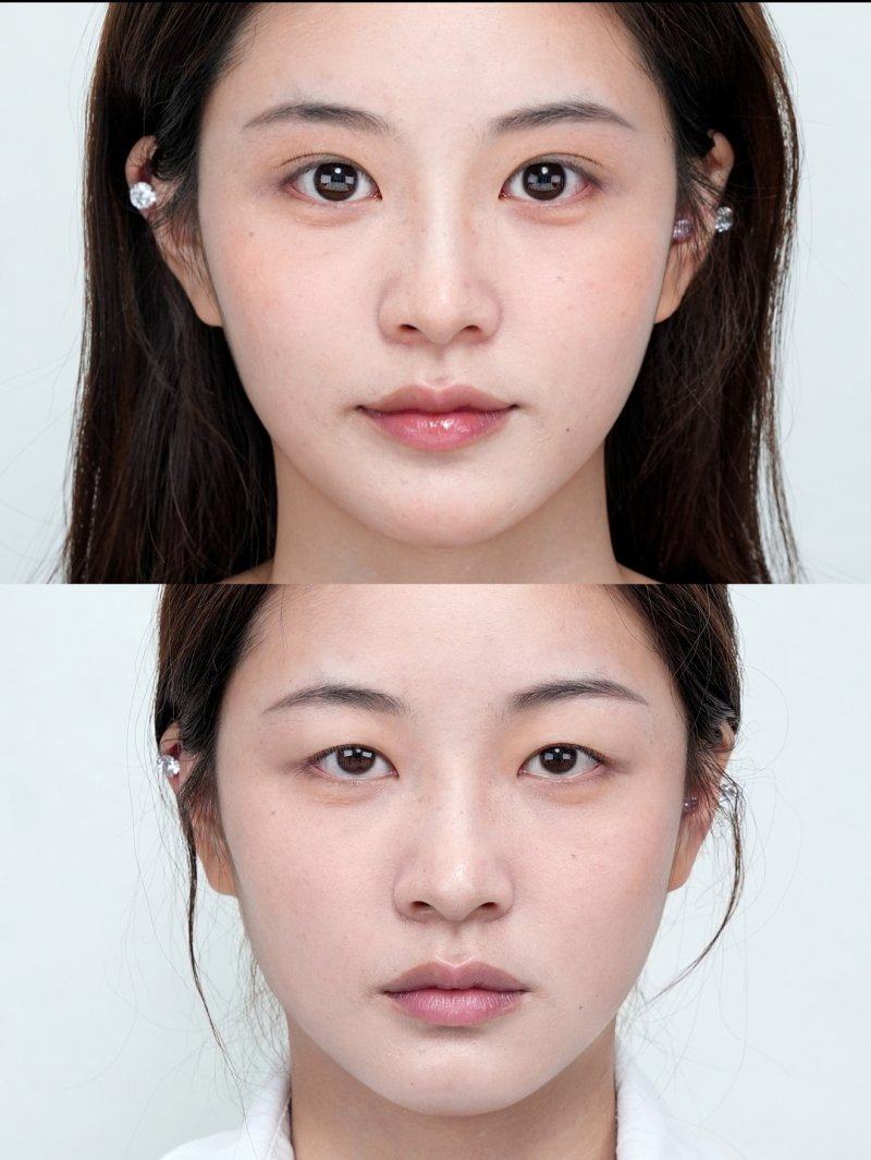 陈秀琴医生预约挂号