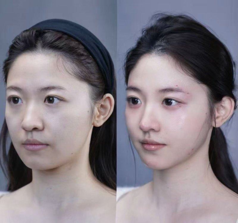 秦瑜医生价格表