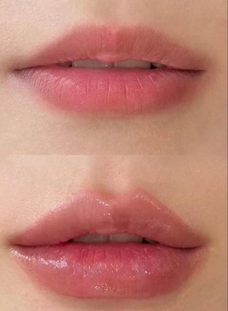 广西菲洛嘉医疗美容门诊部收费价格表/收费标准