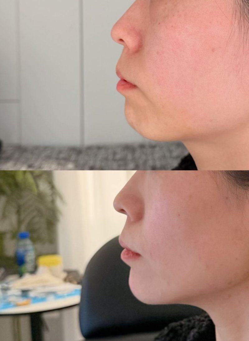 赣州芯美昕医疗美容门诊部收费价格表/收费标准