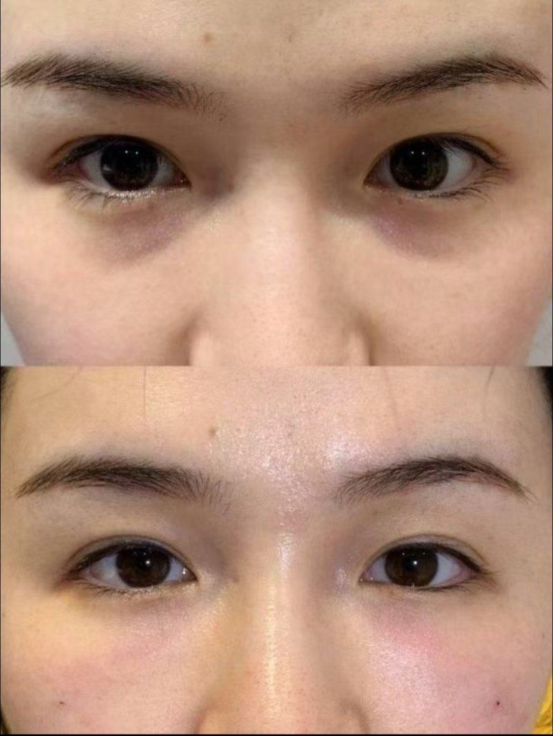 广西菲洛嘉医疗美容门诊部真人口碑评价怎么样？