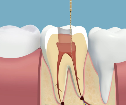 毕节赫章力博尔口腔诊所特色项目及技术优势